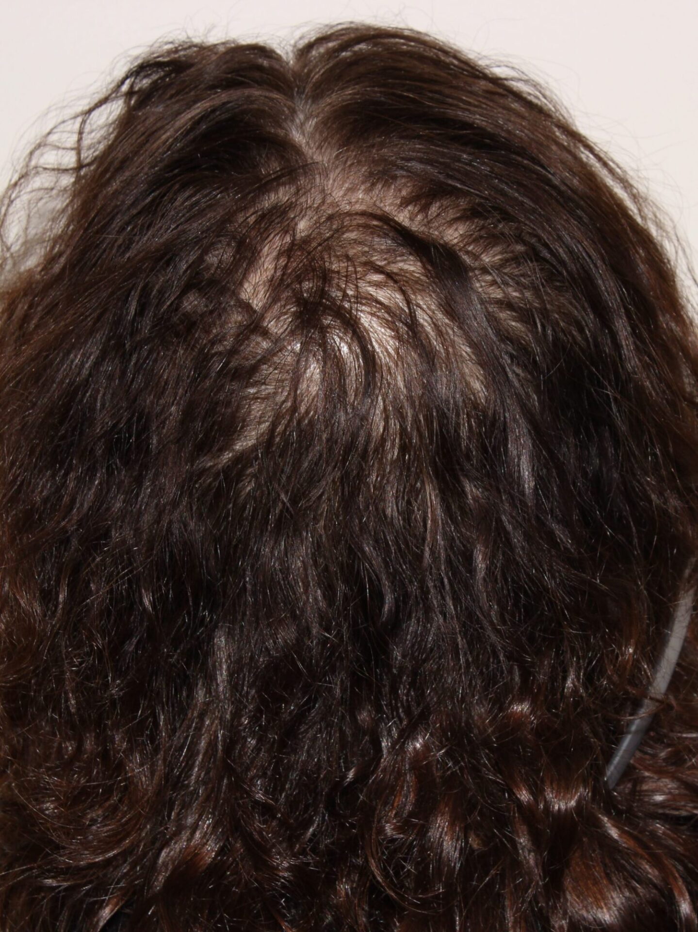 Before-treatment-result