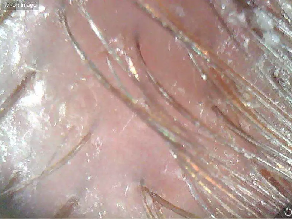 Scalp Care Routine is the key to the prevention of women's hair loss. Medi Tresse Professional Scalp Exfoliation. 