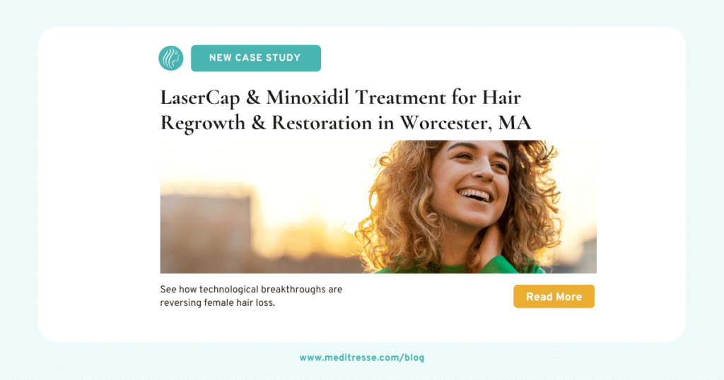 Blog Post OG_ LaserCap and Minoxidil Treatment for Hair Regrowth & Restoration in Worcester MA (1)