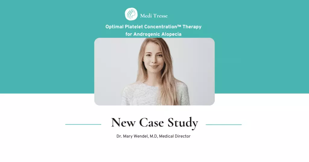 Optimal Platelet Concentration™ Therapy Case Study Overview for Androgenic Alopecia in Worcester, MA Office