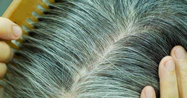 Menopause Hair Loss