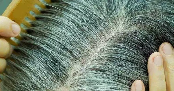 Menopause Hair Loss