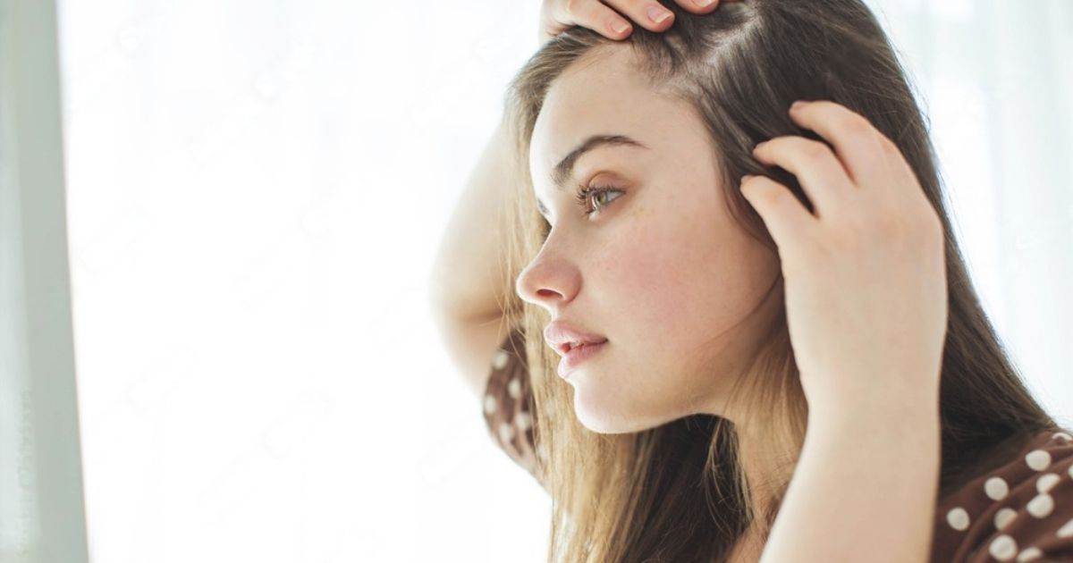woman suffering PCOS related hair loss issue