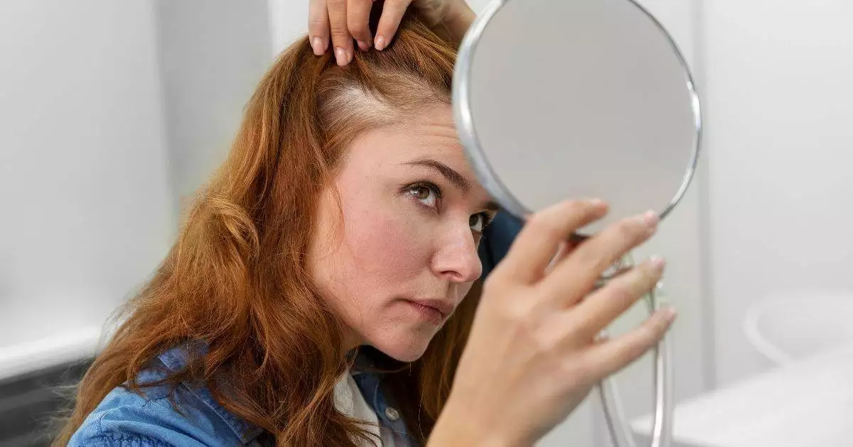 Female suffering  in Vitamin Deficiency Related Hair Loss issue