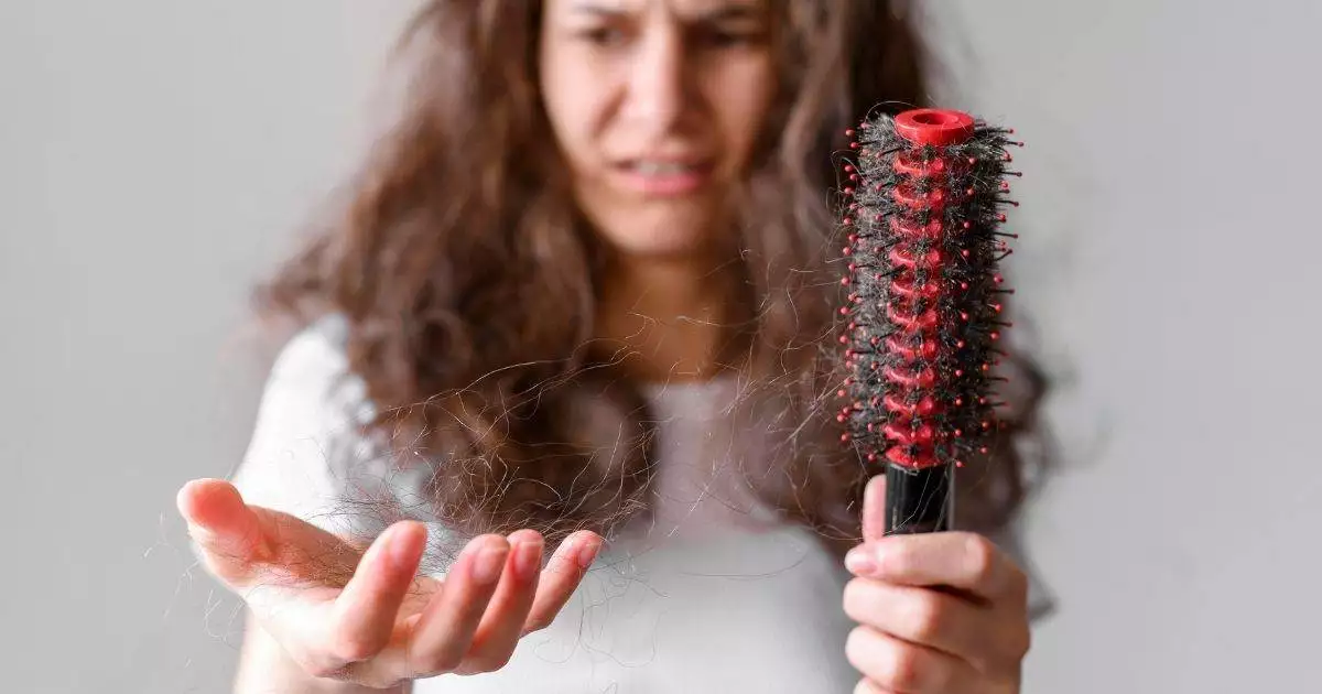 Female suffering  in Thyroid Related Hair Loss issue