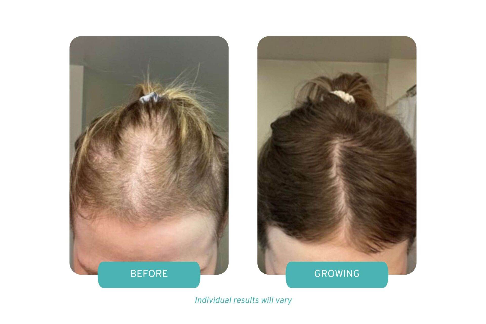 Before and After Image