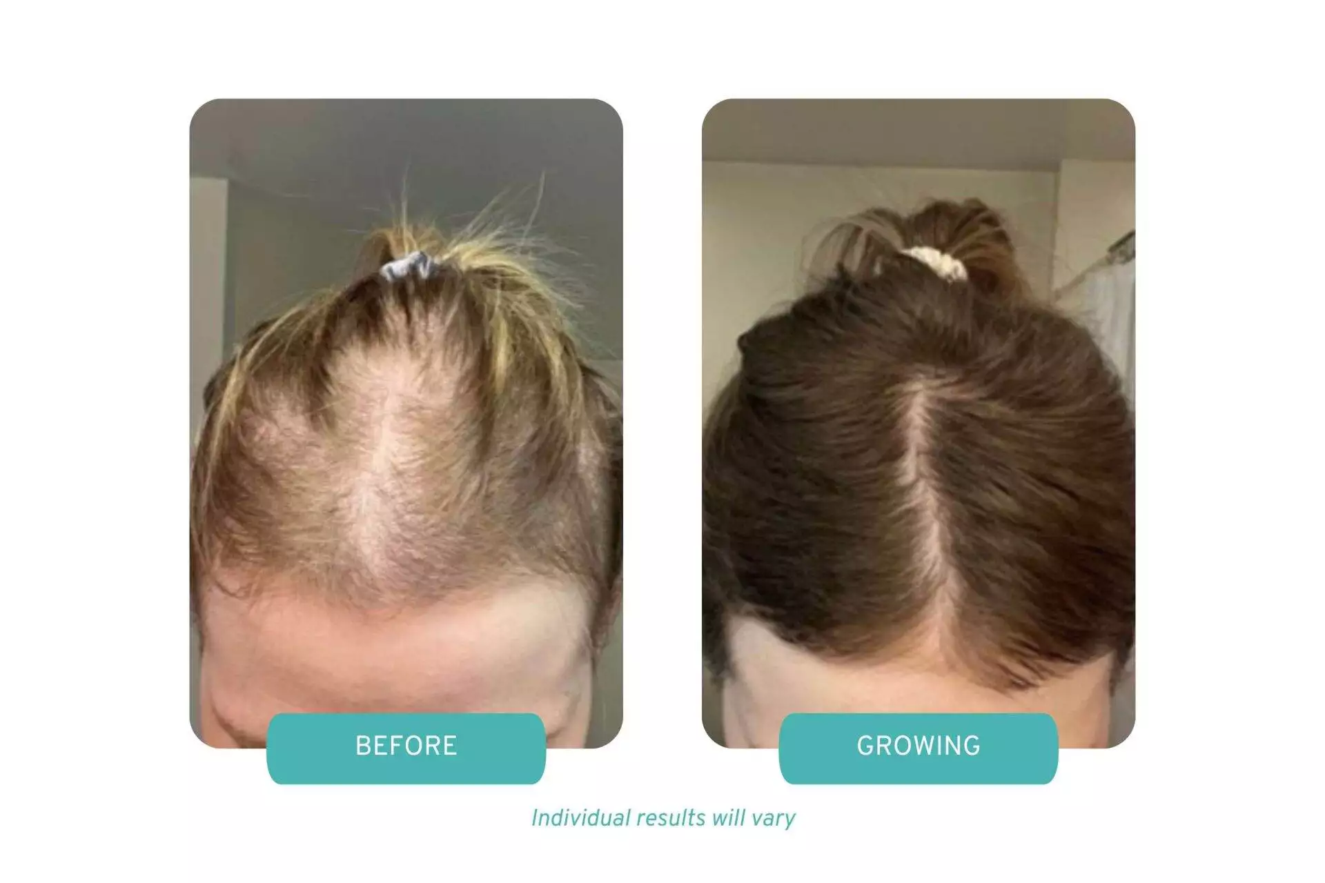 Before and After Image