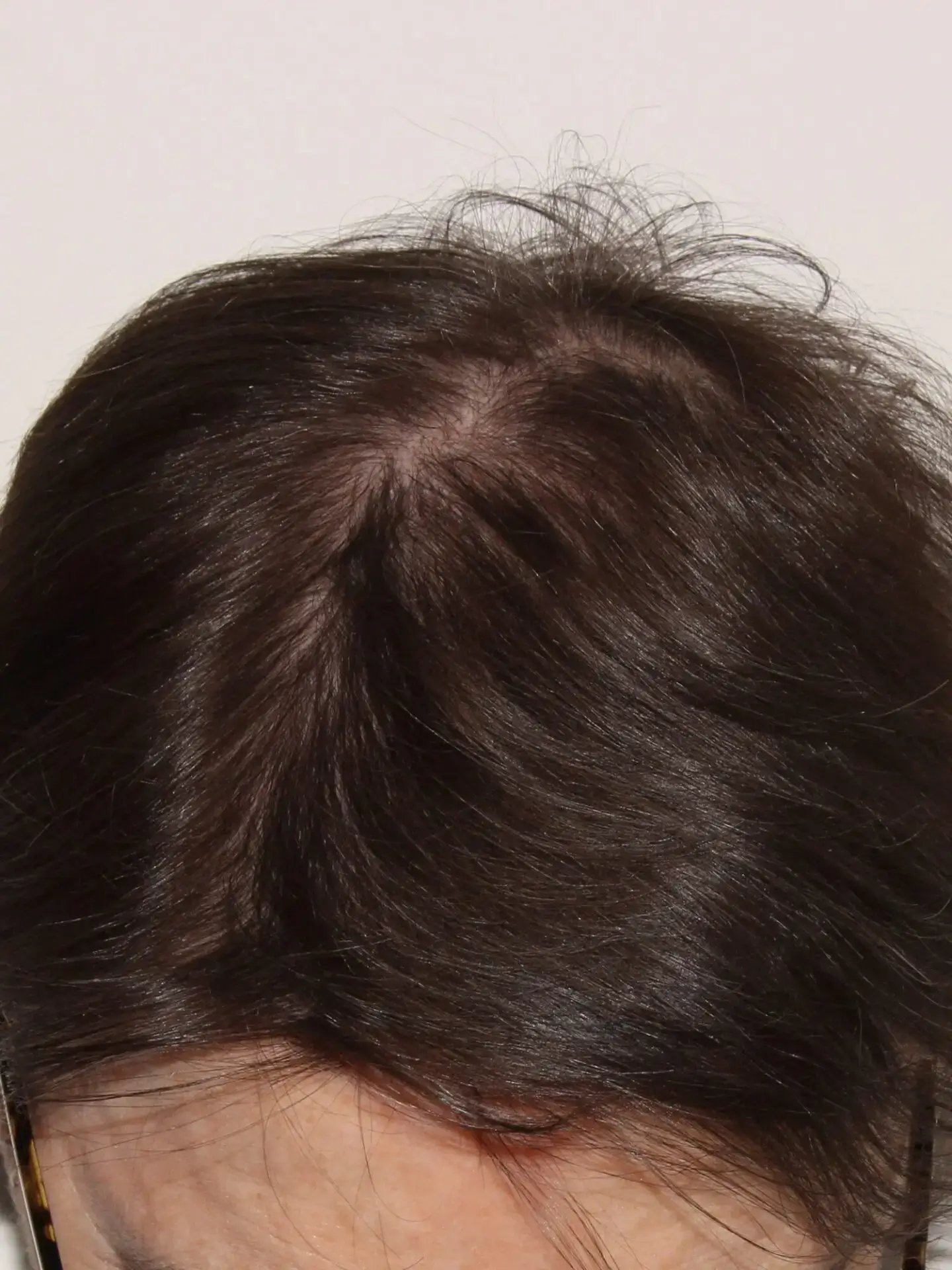 after treatment