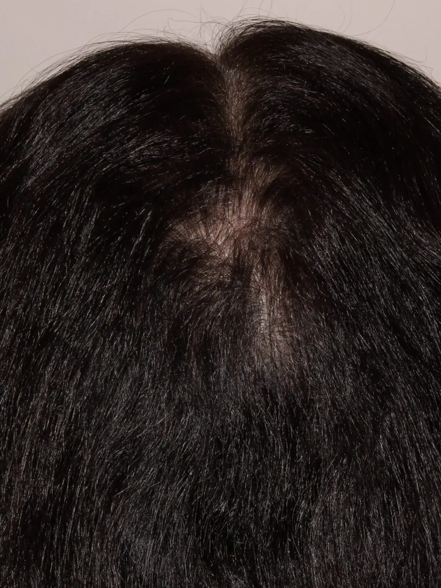 after treatment