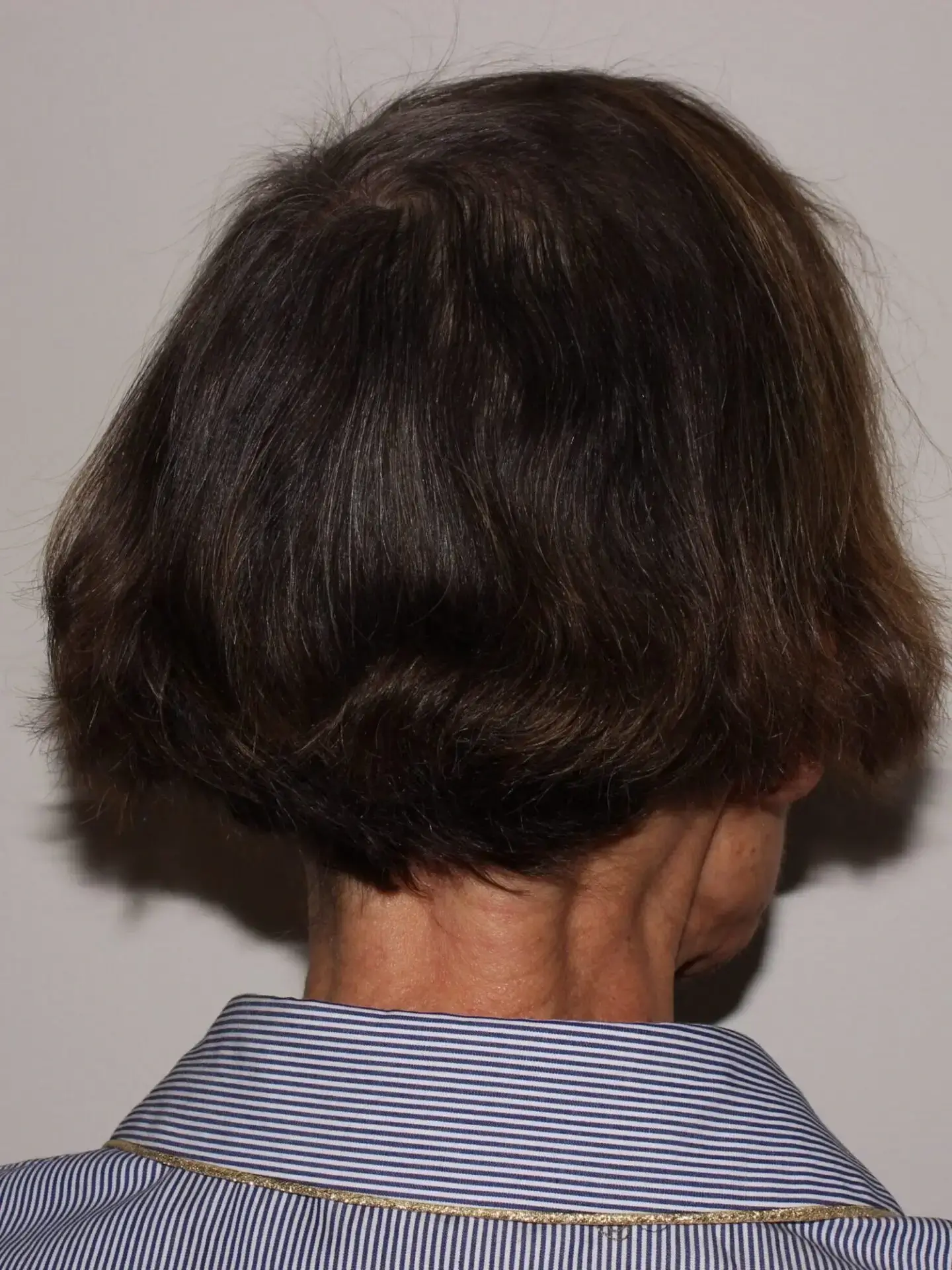 after treatment