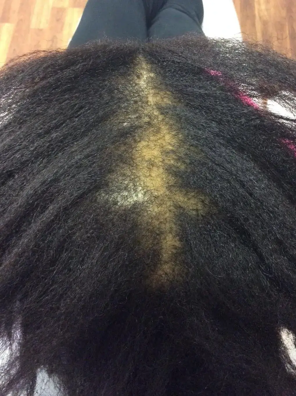 Before treatment