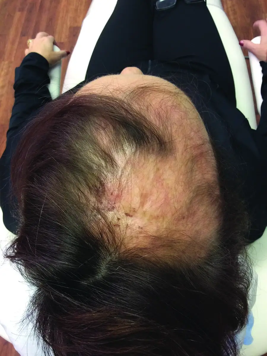 Before photo prior to treatment