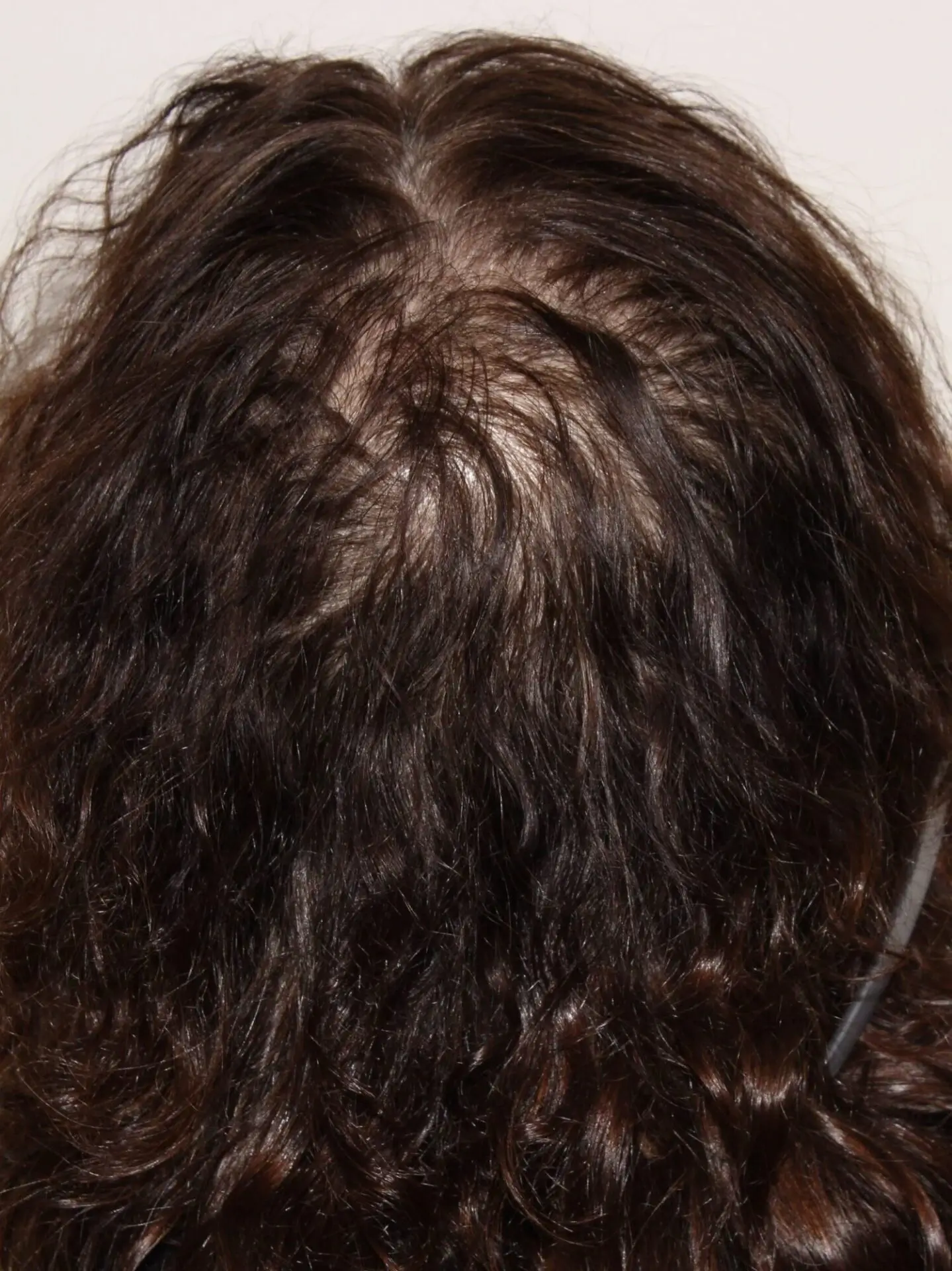Before Treatment