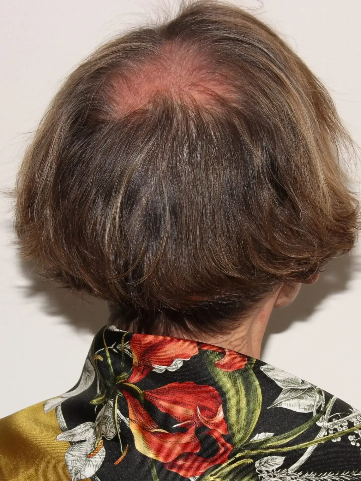 Before treatment