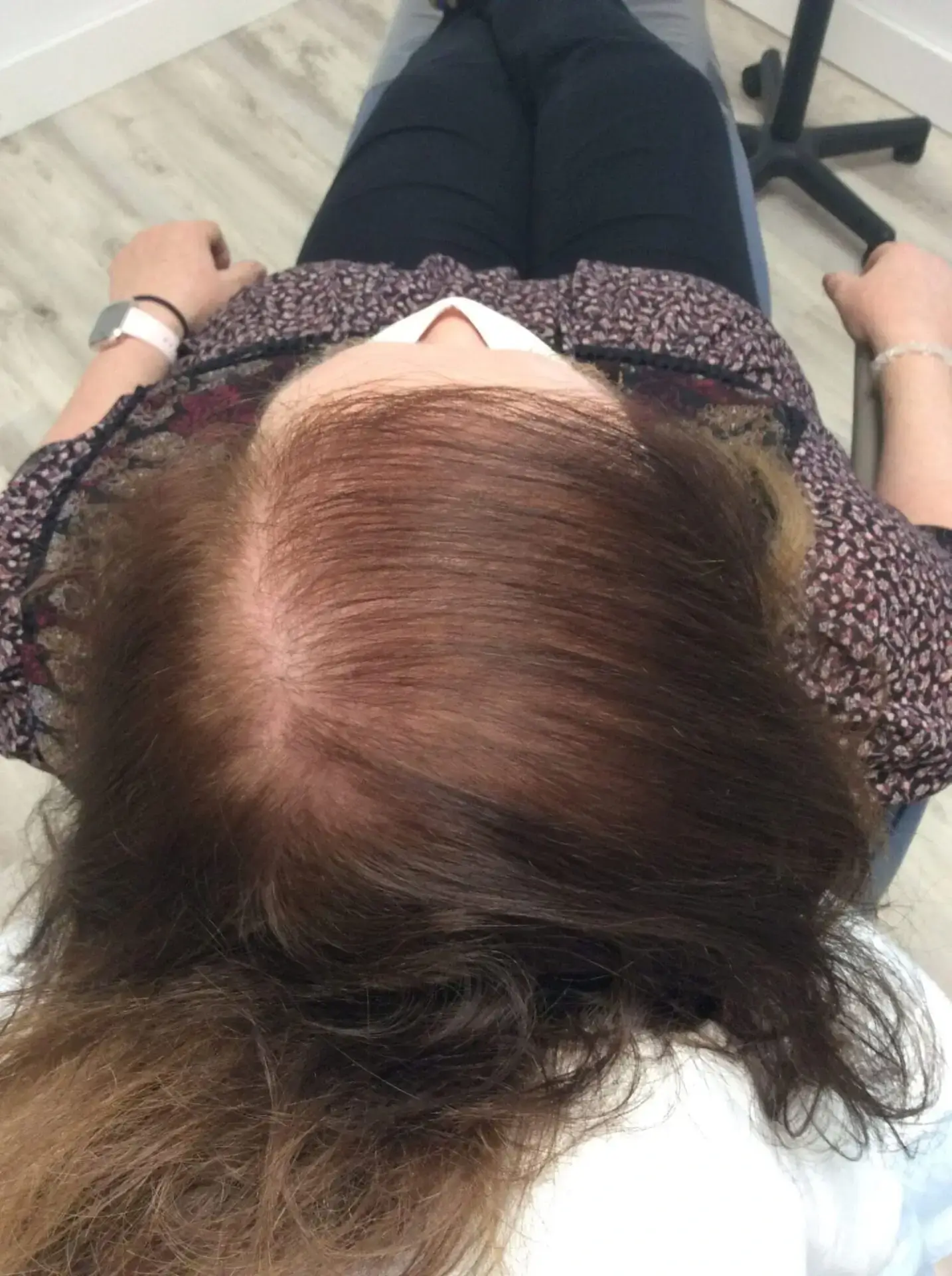before treatment