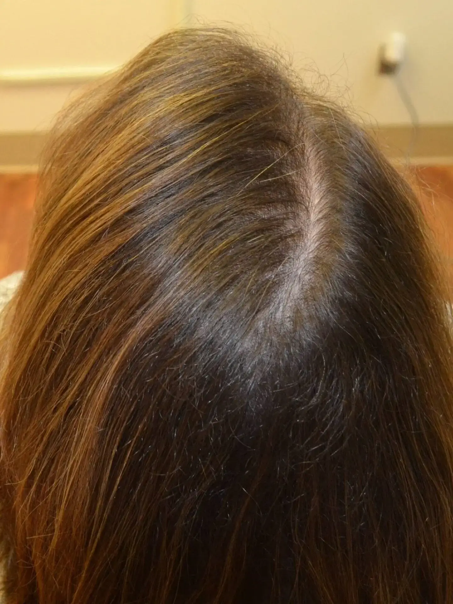 before treatment