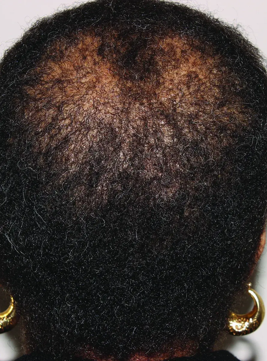 before treatment