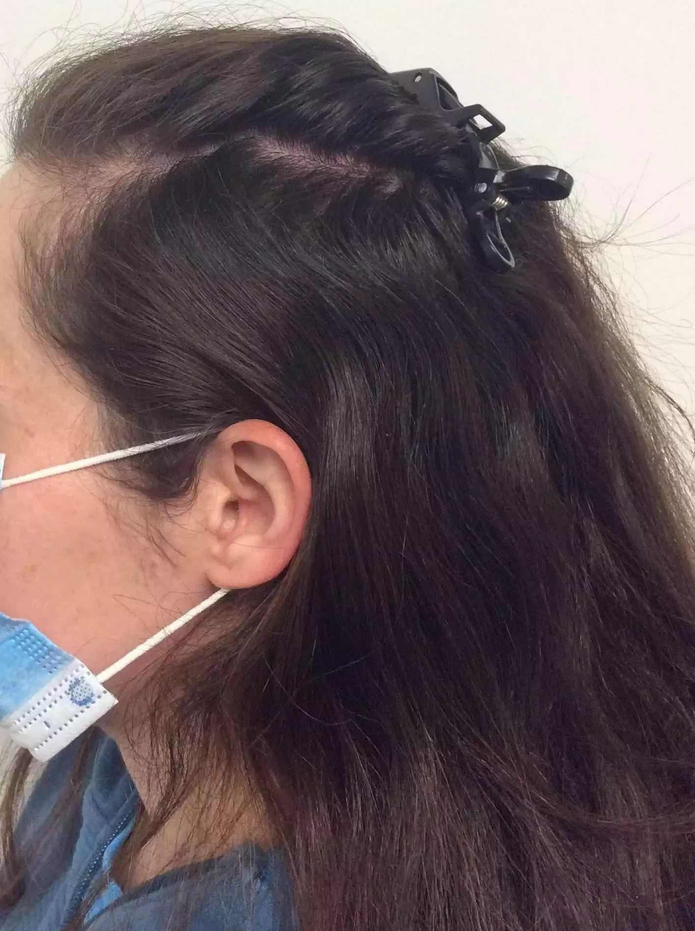 Before treatment